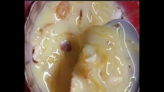 Easy sweet recipe Semiya custard 🍮 quick and simple recipe [upl. by Aicyla]