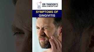 Gingivitis causes and symptoms  Gingivitis HealthyGums DentalCare [upl. by Starobin765]