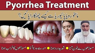 Pyorrhea Treatment In UrduHindi Maskhora Ka Ilaj Danto Ki Dard Ka Ilaj  AlRazaqi Health Recover [upl. by Reivad]