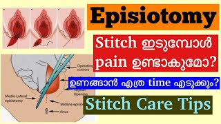 Episiotomy Malayalam│How to take care of Stitches After Normal Delivery│When to consult a Doctor [upl. by Kalikow]