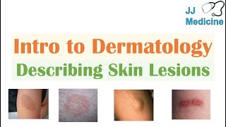 Introduction to Dermatology  The Basics  Describing Skin Lesions Primary amp Secondary Morphology [upl. by Enawd]