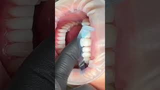 Dental ASMR asmr asmrsounds asmrvideo [upl. by Torrey]