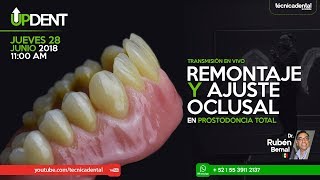 Remontaje y ajuste oclusal en prostodoncia total [upl. by Aicekal]