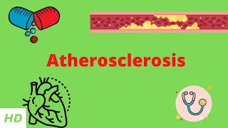 Atherosclerosis Causes Signs and Symptoms Diagnosis and Treatment [upl. by Kirkpatrick]