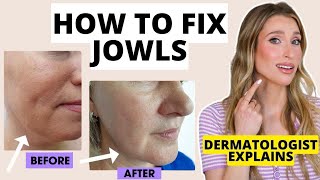 How to Fix Jowls Dermatologist Explains How to Prevent amp Get Rid of Jowls  Dr Sam Ellis [upl. by Harrat]