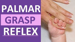 Palmar Grasp Reflex Reaction Infant Newborn Pediatric Nursing Assessment [upl. by Danforth818]