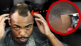 FIXING MY CLIENTS BALD SPOTS😳 HIGH BALD FADE FADED BEARD HAIRCUT TUTORIAL [upl. by Devona]