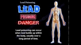 Lead Poisoning  Everything You Need To Know  Dr Nabil Ebraheim [upl. by Erroll]