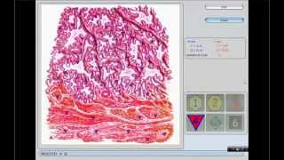 Metatron NLS Bioresonance Health Analyzer [upl. by Nnaharas251]