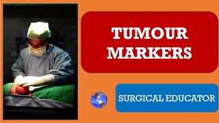 TUMOUR MARKERS FOR SURGEONS [upl. by Adnaloj253]