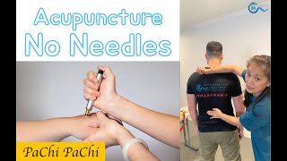 Acupuncture without Needles⚡️Pachi Piezo Electric Stimulator⚡️ EileenHan BalanceMethodAcupuncture [upl. by Bast48]