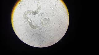 Plant parasitic Nematodes of apricotAphelenchus avenae p2 [upl. by Shoifet]