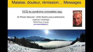 Malaise douleur thoracique rémission récidive Cas clinique et ECG homme 75 ans Dr Taboulet [upl. by Meer508]