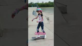 autism autismo shortvideo viral amor viralvideo video humor fofura shorts short squishy [upl. by Yrmac179]