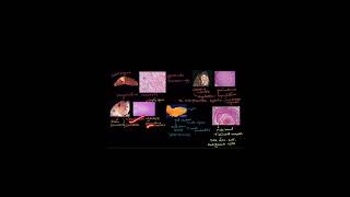 TYPES OF NECROSIS celldamage biology celldeath science cellinjury neet cellulardamage ncert [upl. by Floeter753]