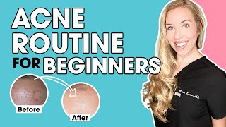 Acne Skincare Routine for Beginners  The Budget Dermatologist [upl. by Darnok]