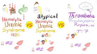 HUS vs aHUS vs TTP [upl. by Croom]