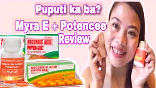 Myra E Potencee Reviewl Puputi Ka Ba  lBest Vitamins for Skin l Hair lMatets TV [upl. by Anat]