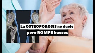 La OSTEOPORIS no duele pero ROMPE HUESOS [upl. by Aronoff648]