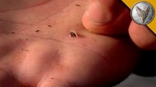 GROSS Baby Leech Burrows Into Coyotes Hand [upl. by Peck164]