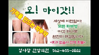 사랑과 은혜 313 모든 피부병을 치료하는 기적의 피부 연고  Miracle Skin Ointment That Cure All Skin Diseases [upl. by Gora]