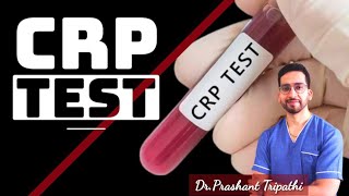 CRP TEST What is CRP  what does CRP positive mean  what is hs CRP [upl. by Eidnahs346]