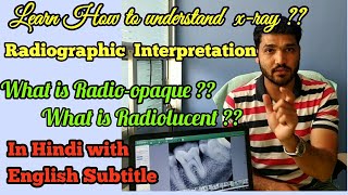 How to understand dental XRAY  Radiographic interpretation  dental radiograph [upl. by Nedia59]