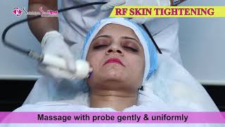 Radio Frequency RF Skin Tightening  Sakhiya Skin Clinic [upl. by Nauqas]