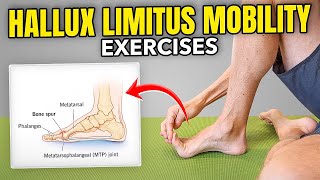 Big Toe Mobility Exercises Hallux Limitus [upl. by Bettzel]