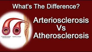 Arteriosclerosis Vs Atherosclerosis  Whats The Difference [upl. by Aserehc488]