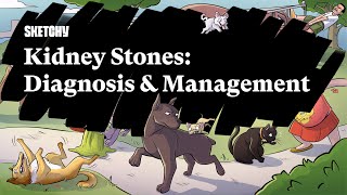 Kidney Stones Overview Diagnosis amp Management Part 1  Sketchy Medical  USMLE Step 2 CK [upl. by Hteik]