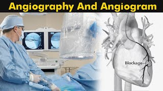 What is Angiography and Angiogram  How Angiography is performed 3D Animation [upl. by Eirod969]