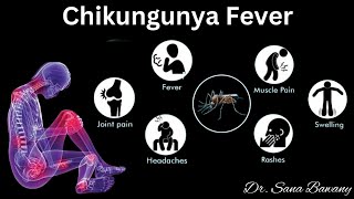 Chikungunya Fever Signs and SymptomsDiagnosis and Treatment [upl. by Anastassia241]