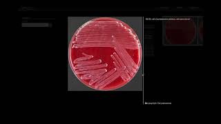 Lipohylic Test  Microbiology [upl. by Ayifa]