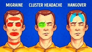 5 Types of Headaches and How to Get Rid of All of Them [upl. by Anawal]