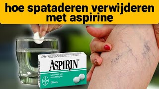 Spataderen verdwenen op de 7e dag neem aspirine en [upl. by Nance]