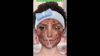 Face treatment cartoon 😱😱🙀 treatment subscribe our channel dosto 👍 [upl. by Arlynne]