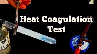 Heat coagulation test  Detection of albumin  Biochemistry [upl. by Franni24]