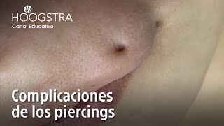 Complicaciones de los piercings  22192 [upl. by Novahs]