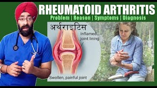 गठिया Rheumatoid Arthritis 1 Hindiआर्थराइटिस  लक्षण कारण जांच amp इलाज  by DrEducation [upl. by Yci]