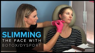 Slimming the Face with BOTOX and Dysport in San Francisco [upl. by Ylyl]