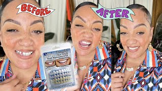 I BOUGHT A TOOTH FROM AMAZON Instant Smile Teeth Kit How I fixed My Missing Tooth Looks So Real [upl. by Ellainad353]