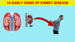 10 Early Signs Of Kidney Disease [upl. by Assirahc]