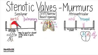 Heart Murmurs and Valve Disease Heart Murmur Series [upl. by Ardnohs]