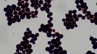 Cryptococcus neoformans in Gram stained smear of culture at various magnifications [upl. by Allenod874]