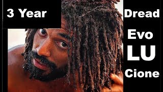 36 Year Dreadlock Timelapse  Progression  Freeform [upl. by Yralih827]