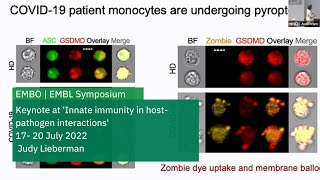 Fanning the Flames Pyroptosis in Bacterial and Viral Infection [upl. by Moritz]