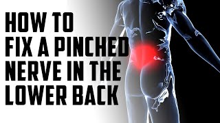 How to fix a pinched nerve in the lower back  episode 14 [upl. by Ear]