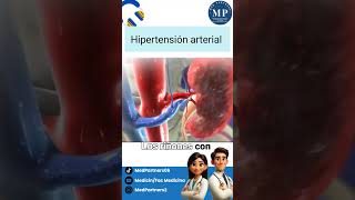 Hipertensión arterial primaria y secundaria shorts medicinahumana [upl. by Zetra882]