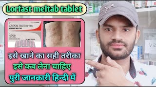 Lorfast meltab tablet use dose benefits and side effects full review in hindi loratadine [upl. by Gersham]